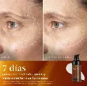 c tetra aadvanced2.webp
