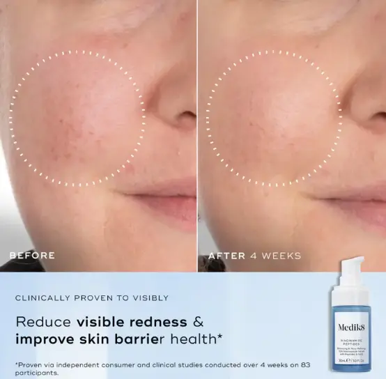 niacinamide peptides 2.webp