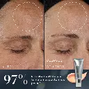 Medik8-CrystalRetinal-AntesyDespues-ROWcopy.webp
