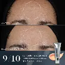 Medik8-CrystalRetinal-Antesydespues2-ROWcopy.webp