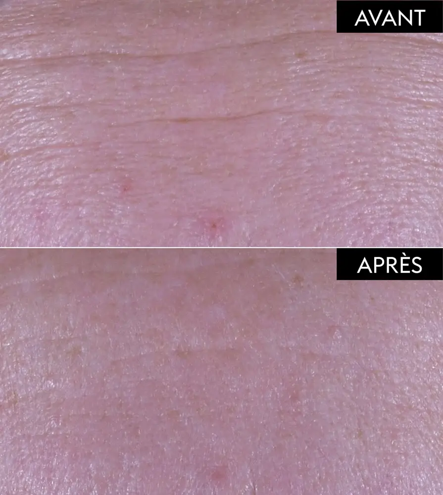 Fiche-produit_claim_avant_apres_SRF-1100x895.webp
