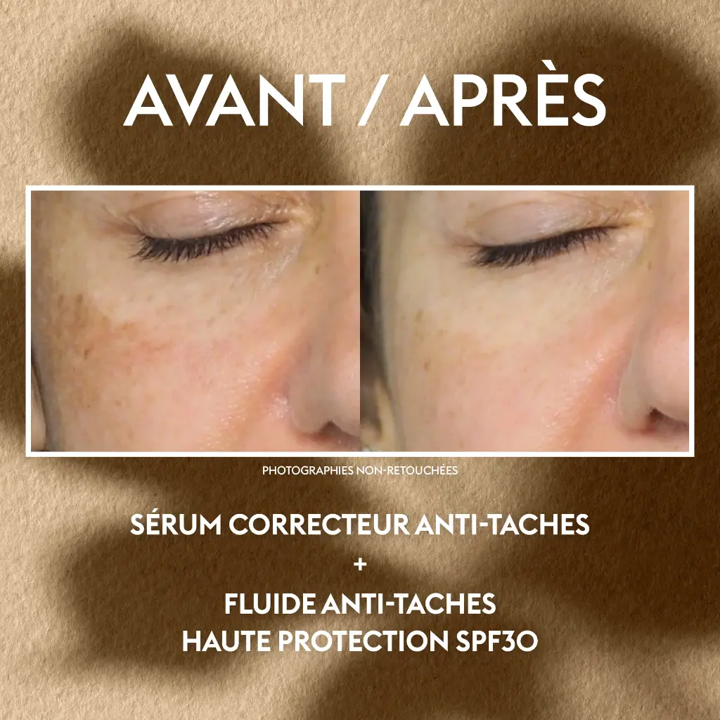 15-04_FOCUS_AVANT-APRES_ATP_v2a_1.webp