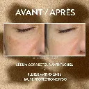 15-04_FOCUS_AVANT-APRES_ATP_v2a_1.webp