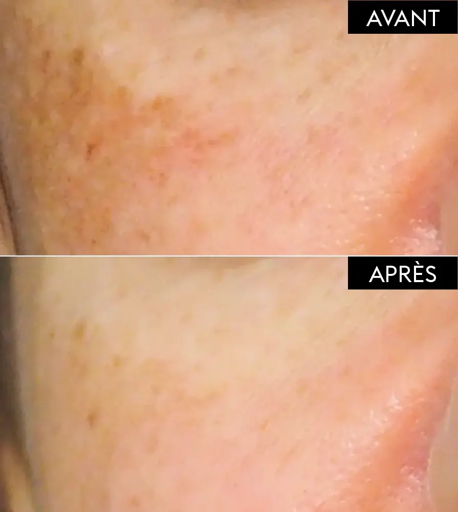 Fiche-produit_claim_avant_apres_ATP-895x1000px.webp