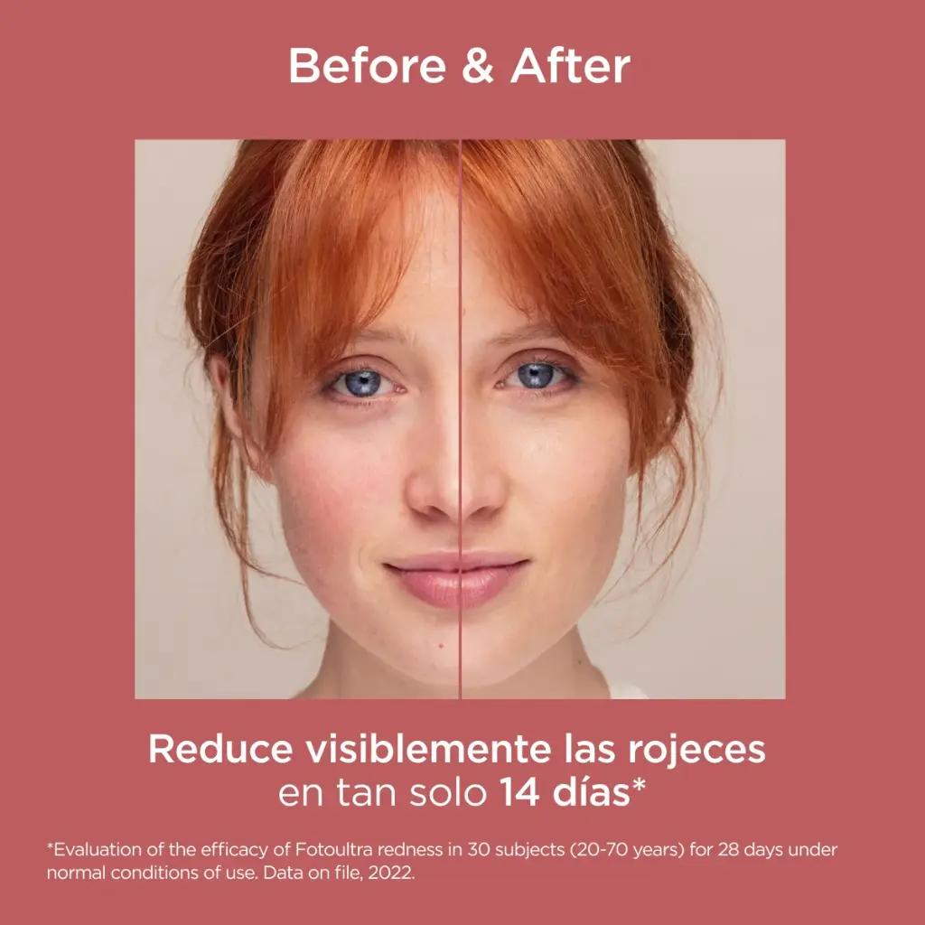 ES_4186_TH_FUREDNESSSPF5050ML_BEFORE_AFTER_3.webp